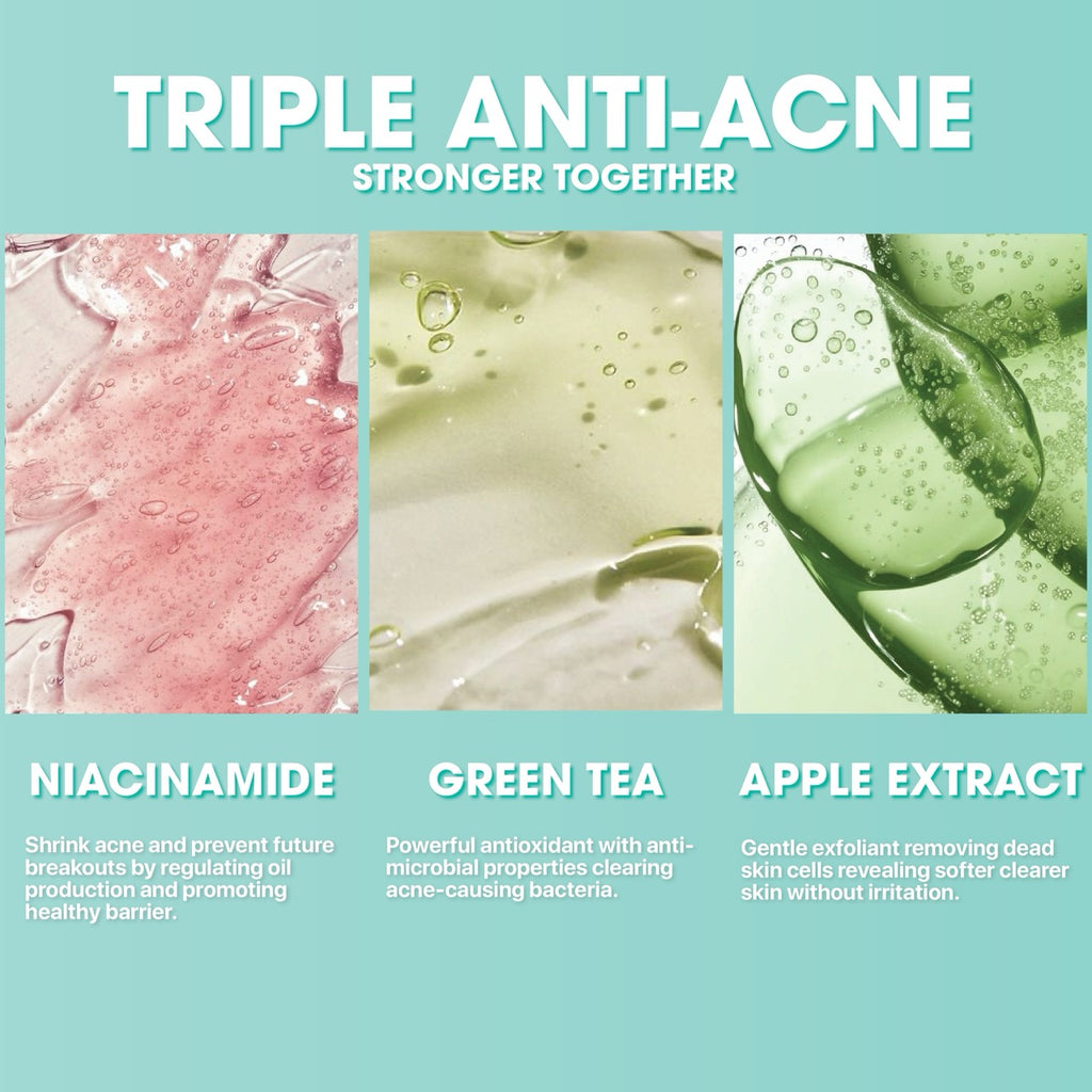 Anti-Acne Blemish Solution Set
