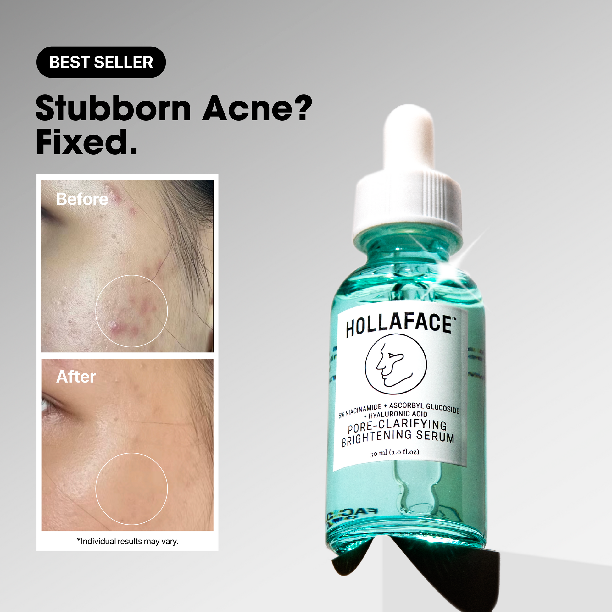 Hollaface Pore-Clarifying Brightening Serum (5% Niacinamide + Ascorbyl Glucoside) (Blueprint Edition)
