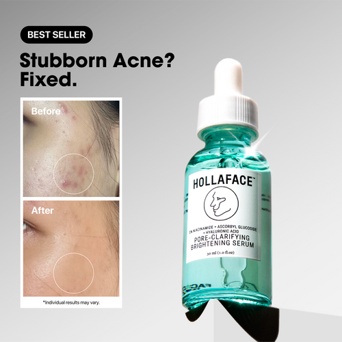 Hollaface Pore-Clarifying Brightening Serum (5% Niacinamide + Ascorbyl Glucoside) (Blueprint Edition)