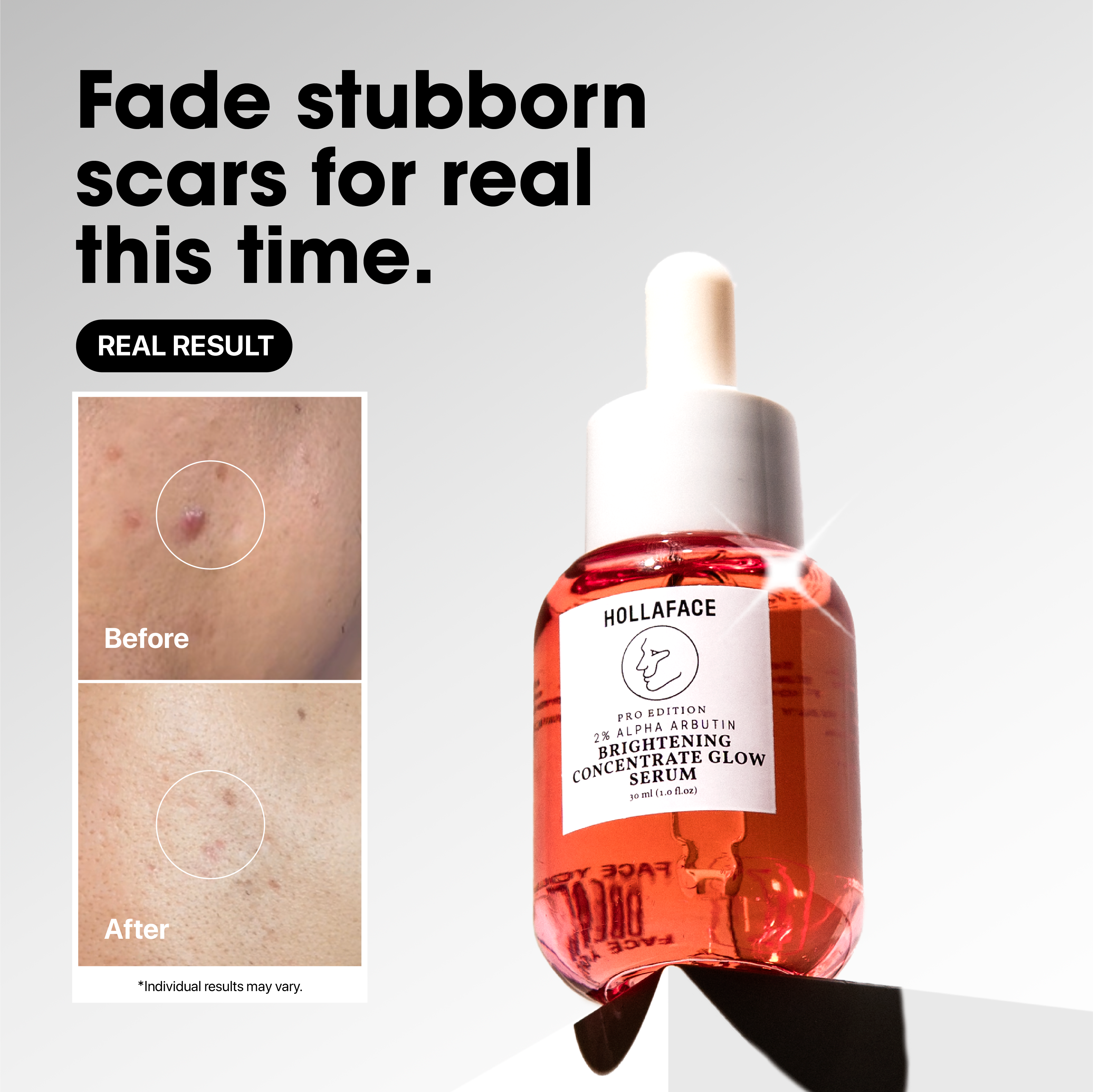 Hollaface Brightening Concentrate Glow Serum (Pro Edition)