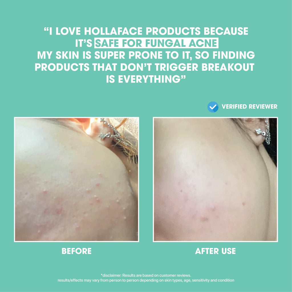 Hollaface Pore-Clarifying Brightening Serum (5% Niacinamide + Ascorbyl Glucoside) (Blueprint Edition)