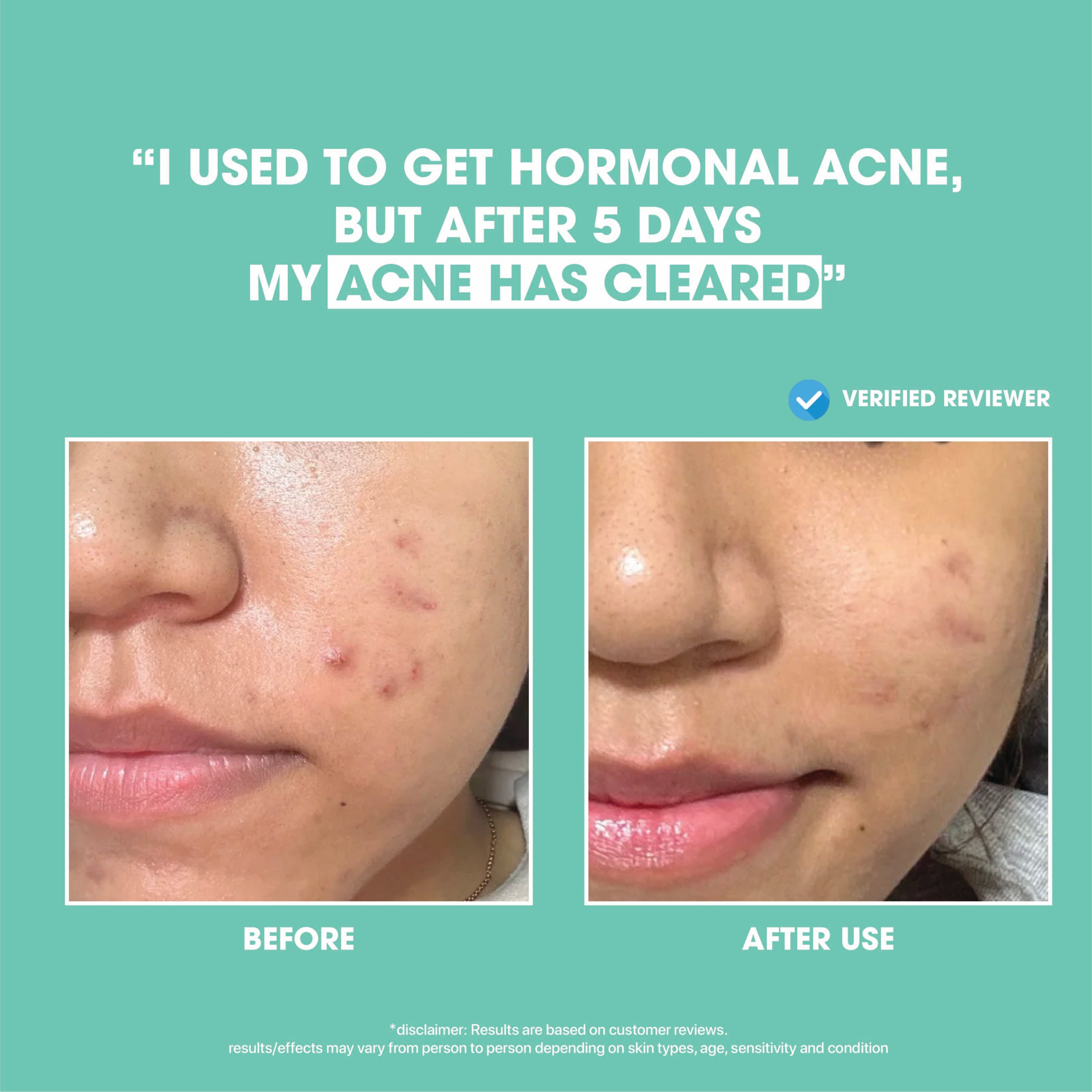 Hollaface Pore-Clarifying Brightening Serum (5% Niacinamide + Ascorbyl Glucoside) (Blueprint Edition)